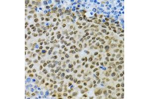 Immunohistochemistry (Paraffin-embedded Sections) (IHC (p)) image for anti-ELAV (Embryonic Lethal, Abnormal Vision, Drosophila)-Like 1 (Hu Antigen R) (ELAVL1) (AA 1-326) antibody (ABIN3022231)
