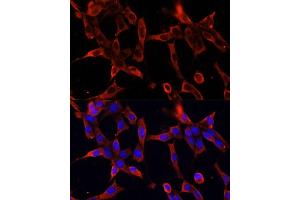 Immunofluorescence (IF) image for anti-Fibrillin 1 (FBN1) (AA 360-460) antibody (ABIN7267176)