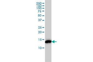 RPS19 monoclonal antibody (M01), clone 3C6 Western Blot analysis of RPS19 expression in K-562 .