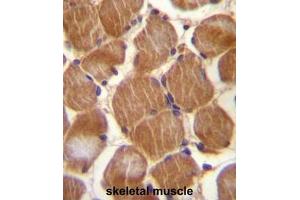 ASAM Antibody (Center) immunohistochemistry analysis in formalin fixed and paraffin embedded human skeletal muscle followed by peroxidase conjugation of the secondary antibody and DAB staining. (CLMP antibody  (Middle Region))