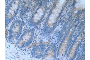 Immunohistochemistry (IHC) image for anti-Latexin (LXN) (AA 1-223) antibody (ABIN7442057)