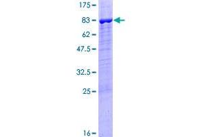 PPP2R5B Protein (AA 1-497) (GST tag)