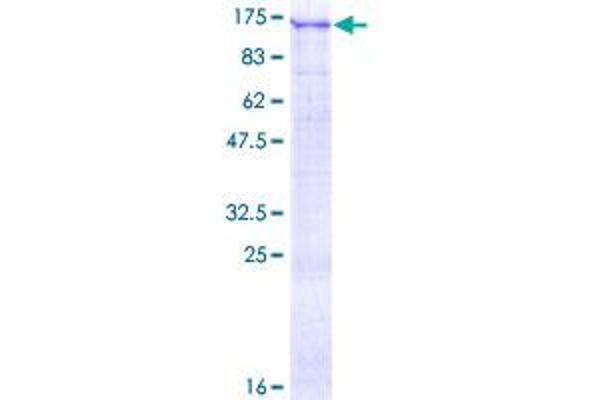 USP1 Protein (AA 1-785) (GST tag)