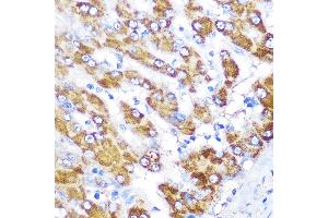 Immunohistochemistry of paraffin-embedded human liver using GATM Rabbit pAb (ABIN6133283, ABIN6140984, ABIN6140985 and ABIN6222282) at dilution of 1:100 (40x lens). (GATM antibody  (AA 124-423))