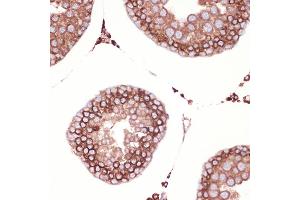 Immunohistochemistry of paraffin-embedded rat testis using Peroxiredoxin 4 (PRDX4) (PRDX4) Rabbit mAb (ABIN7269238) at dilution of 1:100 (40x lens). (Peroxiredoxin 4 antibody)