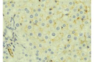 ABIN6276983 at 1/100 staining Mouse liver tissue by IHC-P.