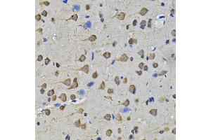 Immunohistochemistry of paraffin-embedded rat brain using N6AMT1 Antibody (ABIN2564018) at dilution of 1:100 (40x lens).
