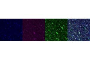 Immunohistochemistry (IHC) image for anti-ATP Synthase, H+ Transporting, Mitochondrial F1 Complex, alpha Subunit 1, Cardiac Muscle (ATP5A1) antibody (ABIN7456312)