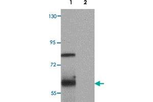 Western blot analysis of TYW1 in human lung tissue lysate with TYW1 polyclonal antibody  at 1 ug/mL.