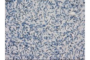 Image no. 9 for anti-Fc gamma RII (CD32) antibody (ABIN1497255) (Fc gamma RII (CD32) antibody)