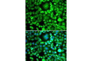 Immunofluorescence analysis of MCF-7 cells using BLID antibody (ABIN5974377). (BLID antibody)