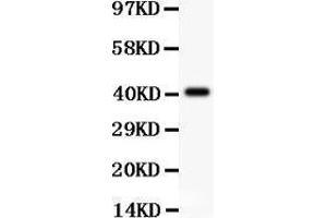 Anti-Tuberin Picoband antibody,  All lanes: Anti Tuberin  at 0. (Tuberin antibody  (AA 1611-1807))