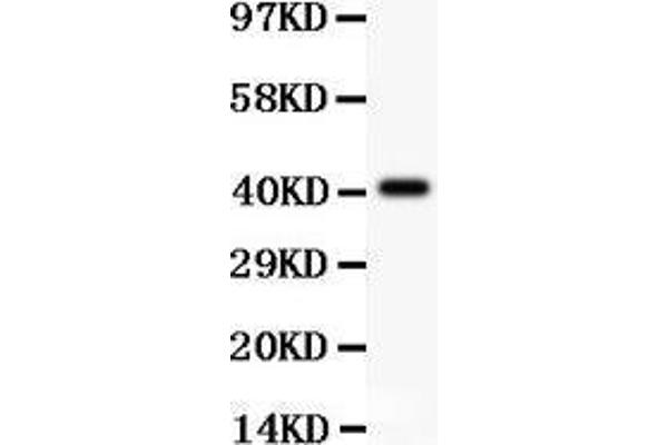 Tuberin antibody  (AA 1611-1807)