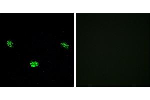 P-peptide - +Immunofluorescence analysis of LOVO cells, using HNF4α (Phospho-Ser313) antibody. (HNF4A antibody  (pSer313))