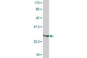 Western Blot detection against Immunogen (37. (HCCS antibody  (AA 169-268))