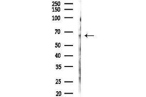 anti-Solute Carrier Family 47, Member 2 (SLC47A2) antibody