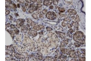 Immunoperoxidase of monoclonal antibody to ASB8 on formalin-fixed paraffin-embedded human pancreas. (ASB8 antibody  (AA 179-288))