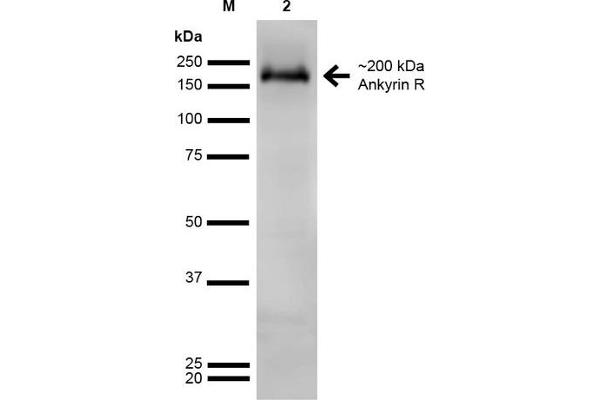 Erythrocyte Ankyrin antibody  (AA 1-1881)