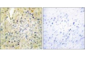DLEC1 antibody  (AA 1-50)