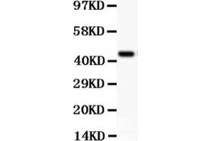 Western blot analysis of CD11b using anti-CD11b antibody (ABIN3043258). (CD11b antibody  (AA 17-382))