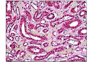 Immunohistochemistry (IHC) image for anti-Acid Phosphatase 2, Lysosomal (ACP2) antibody (ABIN781949) (ACP2 antibody)