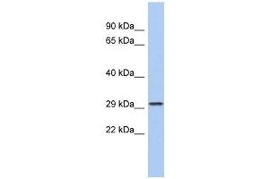 CACNG6 antibody used at 1 ug/ml to detect target protein. (CACNG6 antibody  (N-Term))