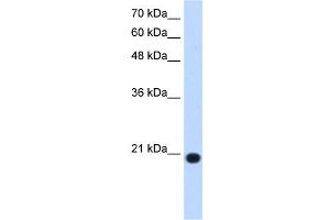 UXT antibody used at 1. (UXT antibody  (N-Term))