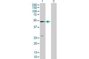 Western Blot analysis of NT5C2 expression in transfected 293T cell line by NT5C2 MaxPab polyclonal antibody. (NT5C2 antibody  (AA 1-561))