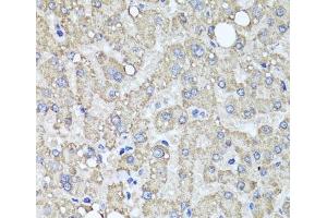 Immunohistochemistry of paraffin-embedded Human liver damage using MUC16 Polyclonal Antibody at dilution of 1:100 (40x lens). (MUC16 antibody)