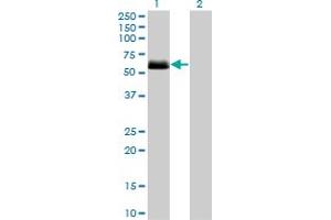 Western Blot analysis of CSNK1G2 expression in transfected 293T cell line by CSNK1G2 monoclonal antibody (M08), clone 2F5.