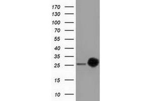 HEK293T cells were transfected with the pCMV6-ENTRY control (Left lane) or pCMV6-ENTRY CLPP (Right lane) cDNA for 48 hrs and lysed. (CLPP antibody)