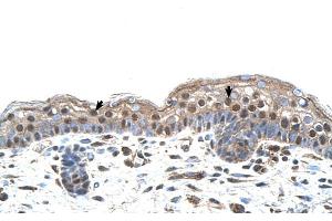 Human Skin (IRF4 antibody  (N-Term))