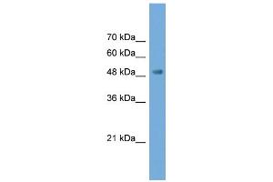 WB Suggested Anti-NPTX2 Antibody Titration: 0.