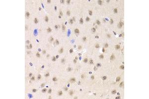 Immunohistochemistry of paraffin-embedded mouse brain using PRPF3 Antibody (ABIN1876670) at dilution of 1:100 (40x lens). (PRPF3 antibody)