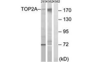 Western blot analysis of extracts from K562/293 cells, using TOP2A (Ab-1525) Antibody.