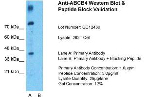 Host: Rabbit  Target Name: ABCB4  Sample Tissue: 293T Whole Cell  Lane A:  Primary Antibody Lane B: Primary Antibody + Blocking Peptide Primary Antibody Concentration: 1 µg/mL Peptide Concentration: 9 µg/mL Lysate Quantity: 941 µg/lane/LaneGel Concentration: 9. (ABCB4 antibody  (N-Term))