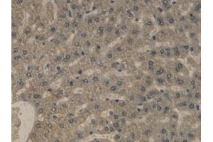 Immunohistochemistry (IHC) image for anti-Apolipoprotein B (APOB) (AA 2747-2913) antibody (ABIN7426895)