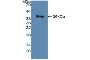 Detection of Recombinant ABCA1, Human using Polyclonal Antibody to ATP Binding Cassette Transporter A1 (ABCA1) (ABCA1 antibody  (AA 1385-1663))