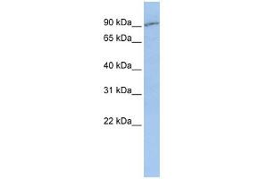 SLC15A2 antibody used at 1 ug/ml to detect target protein.