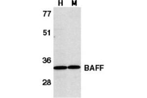 Image no. 2 for anti-Tumor Necrosis Factor (Ligand) Superfamily, Member 13b (TNFSF13B) (C-Term) antibody (ABIN204251) (BAFF antibody  (C-Term))