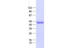Western Blotting (WB) image for WD Repeat Domain 31 (WDR31) protein (His tag) (ABIN2735508)