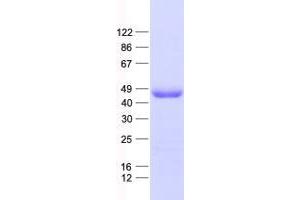 Validation with Western Blot (WDR31 Protein (His tag))