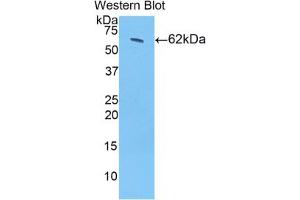 Western blot analysis of the recombinant protein. (HSD17B12 antibody  (AA 1-312))