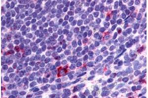 Anti-CCR2 antibody  ABIN1048390 IHC staining of human spleen, lymphocytes. (CCR2 antibody  (N-Term))