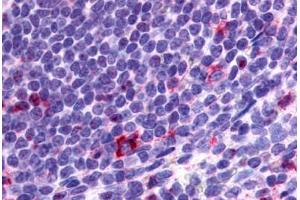 Anti-CCR2 antibody  ABIN1048390 IHC staining of human spleen, lymphocytes.