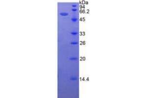 SDS-PAGE analysis of Human Intercellular Adhesion Molecule 5 Protein. (ICAM5 Protein)
