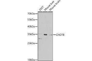 Western blot analysis of extracts of various cell lines, using CNOT8 antibody (ABIN6127644, ABIN6138786, ABIN6138788 and ABIN6224080) at 1:1000 dilution. (CNOT8 antibody  (AA 1-292))