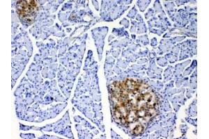 IHC testing of FFPE rat pancreas tissue with IL17A antibody at 1ug/ml. (Interleukin 17a antibody)