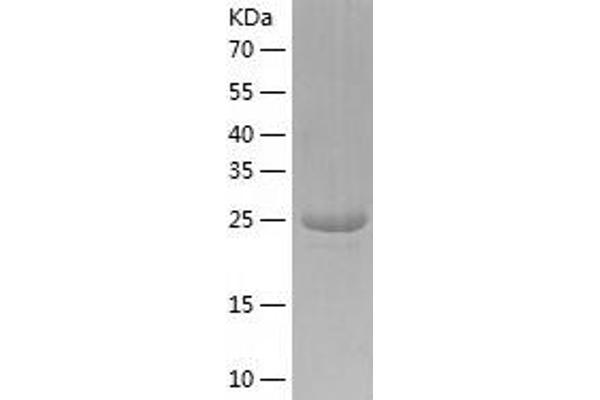 MAPRE3 Protein (AA 1-281) (His tag)