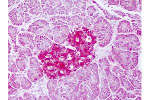 Ferritin Mitochondrial antibody  (AA 98-147)